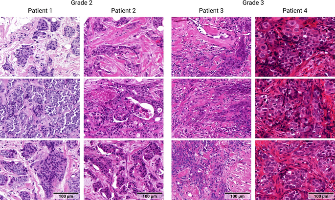Recommendations on compiling test datasets for evaluating artificial intelligence solutions in pathology